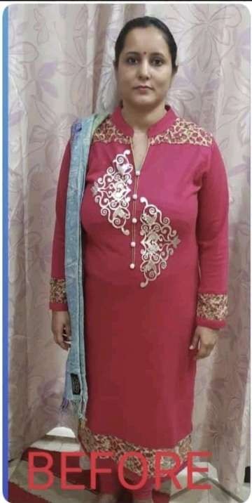 Dr. Nidhi Transformation Before